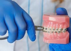 Прием к стоматологу ортодонту