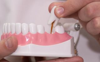 Запись на прием к стоматологу ортопеду